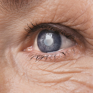 Main Street Eye Care | Contact Lens Exams, Pediatric Eye Care and Emergency Eye Care